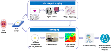Graphical abstract: FTIR-based machine learning for prediction of malignant transformation in oral epithelial dysplasia