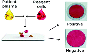 Graphical abstract: Wash-free paper diagnostics for the rapid detection of blood type antibodies
