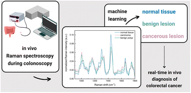 Graphical abstract: In vivo Raman spectroscopy in the diagnostics of colon cancer