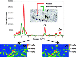 Graphical abstract: Synchrotron radiation based X-ray fluorescence shows changes in the elemental composition of the human substantia nigra in aged brains