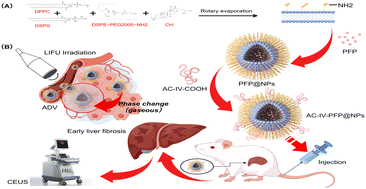 Graphical abstract: Collagen IV-targeted phase-change nanoparticles illuminate early liver fibrosis staging via ultrasound molecular imaging