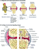 Graphical abstract: Peptide-biofunctionalization of biomaterials for osteochondral tissue regeneration in early stage osteoarthritis: challenges and opportunities