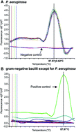 Graphical abstract: Detection methods for Pseudomonas aeruginosa: history and future perspective