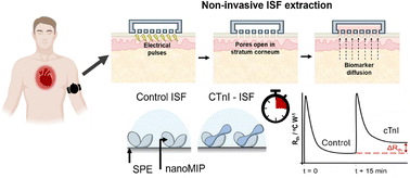 Graphical abstract: Unlocking interstitial fluid for acute coronary syndrome diagnosis: ultrasensitive troponin I detection using imprinted polymer nanoparticles