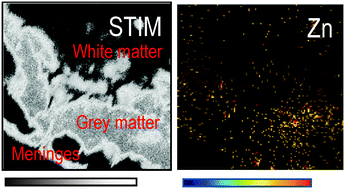 Graphical abstract: Elemental mapping inventory of the fish Liza aurata brain: a biomarker of metal pollution vulnerability