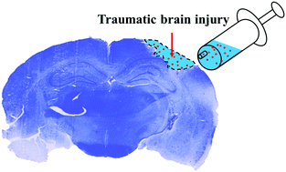 Graphical abstract: Potential application of an injectable hydrogel scaffold loaded with mesenchymal stem cells for treating traumatic brain injury