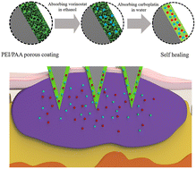 Graphical abstract: Microneedle patch with “spongy coating” to co-load multiple drugs to treat multidrug-resistant melanoma