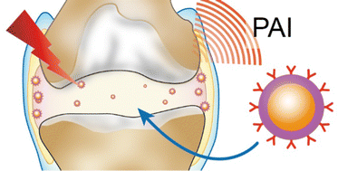 Graphical abstract: Early diagnosis and treatment of osteoarthritis with a Au@PDA-WL NP nano-probe by photoacoustic imaging