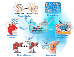 Graphical abstract: Recent progress of antibacterial hydrogel materials for biomedical applications