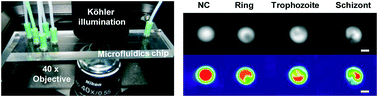 Graphical abstract: Label-free, high-throughput detection of P. falciparum infection in sphered erythrocytes with digital holographic microscopy