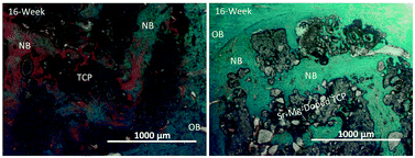 Graphical abstract: 3D printed tricalcium phosphate bone tissue engineering scaffolds: effect of SrO and MgO doping on in vivo osteogenesis in a rat distal femoral defect model