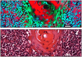 Graphical abstract: Tissue discrimination in head and neck cancer using image fusion of IR and optical microscopy