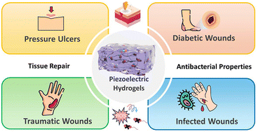 Graphical abstract: Piezoelectric hydrogels for accelerating healing of diverse wound types