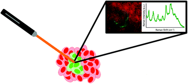 Graphical abstract: Raman technologies in cancer diagnostics