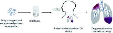 Graphical abstract: Inhaled antibiotic-loaded polymeric nanoparticles for the management of lower respiratory tract infections