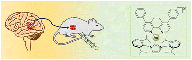 Graphical abstract: An anti-glioblastoma gold(i)–NHC complex distorts mitochondrial morphology and bioenergetics to induce tumor growth inhibition