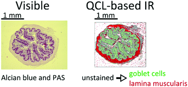 Graphical abstract: Biomedical applications of mid-infrared quantum cascade lasers – a review