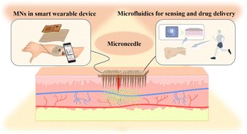 Graphical abstract: Toward next-generation smart medical care wearables: where microfluidics meet microneedles