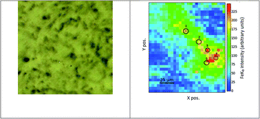 Graphical abstract: Investigation of the iron oxidation state in ovarian cancer using synchrotron micro X-ray absorption near edge structure – preliminary results