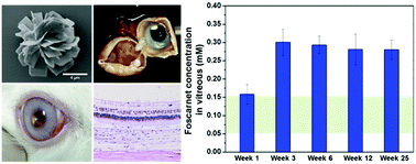 Graphical abstract: Foscarnet calcium microcrystals as the intravitreal drug depot